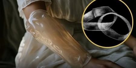 هذا الإبتكار الجديد يشفي الجروح بالكامل في 24 ساعة فقط ..فكيف يعمل! - تليجراف الخليج