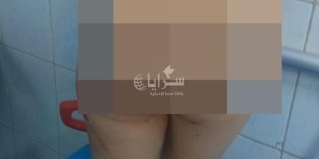 بالفيديو والصور .. كلاب ضالة تنهش جسد طفل في “الضاحية” بالمفرق .. وذووه يناشدون الجهات المعنية - تليجراف الخليج