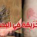 لسعة الحريقة في البحر: مخاطرها وكيفية التعامل معها - تليجراف الخليج