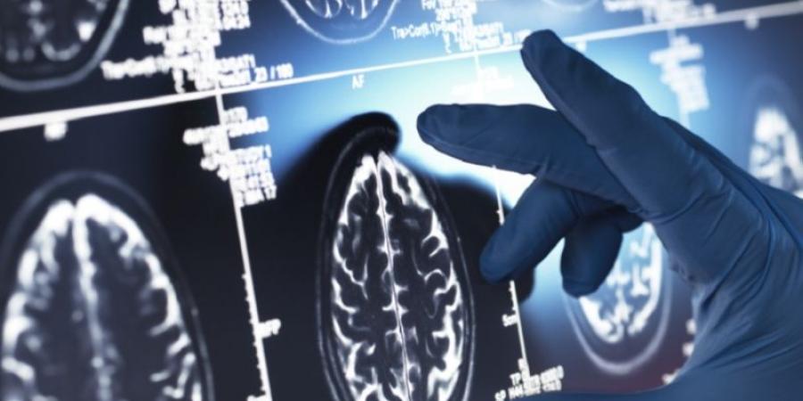 مقاومة الإنسولين في الدماغ العامل المشترك بين ألزهايمر والصرع - تليجراف الخليج